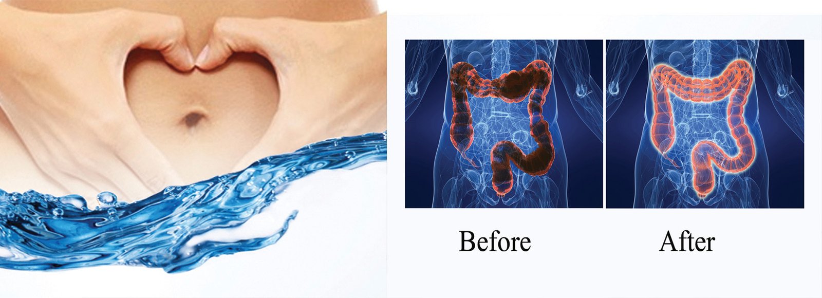 How Much is a Colonic Irrigation Hydrotherapy?