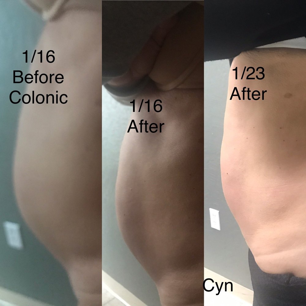 Colonic Irrigation Machine for Sale