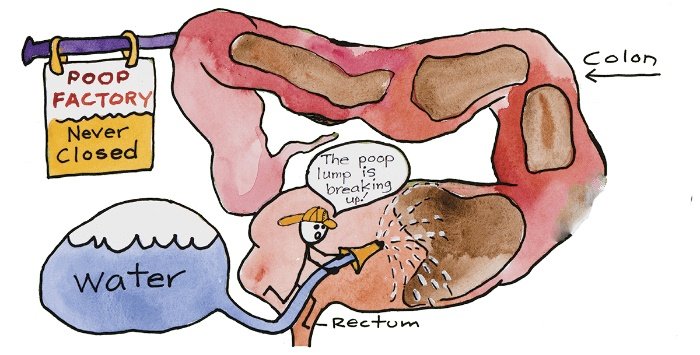 Gebrauchte Colon-Hydro-Therapiegeräte zu verkaufen